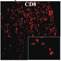 CD8 in ganglia, Khanna et al 2003