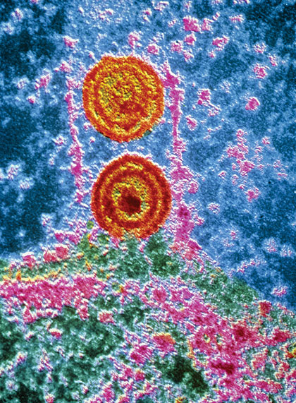 Herpes Simplex (false color) - Pasteur Institute