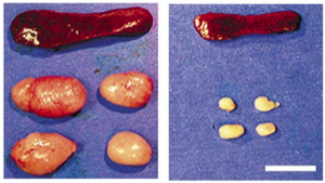 spleen and lymph nodes from an lpr mouse