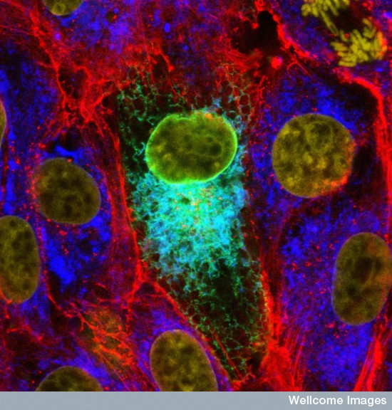 Mumps virus protein (turquoise) in endoplasmic reticulum