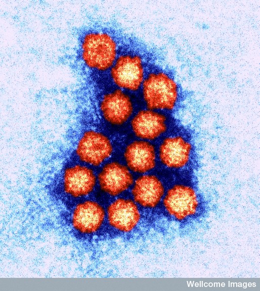 Norovirus (Wellcome)