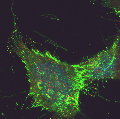 MHVâ€“68 exiting an infected cell on actin-dependent plasma membrane protrusions. EGFPâ€“tagged ORF58 is green, gp150 red, coâ€“localization yellow and nuclei blue (Mike Gill).