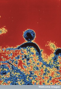 HIV (Wellcome Images)