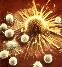 T cells attacking tumor cell