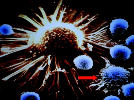CTL attacking a tumor cell