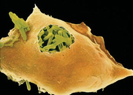 Macrophage and mycobacterium